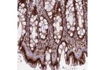 Immunohistochemical staining of human Colon shows strong nuclear positivity in glandular cells.
