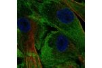 Immunofluorescent staining of human cell line ASC TERT1 shows localization to plasma membrane.