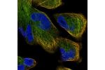 Immunofluorescent staining of human cell line RH-30 shows localization to microtubules.