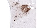 Immunohistochemical staining of human hypothalamus shows strong cytoplasmic positivity in neuronal cells.