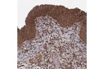 Immunohistochemical staining of human urinary bladder shows strong cytoplasmic positivity in urothelial cells.