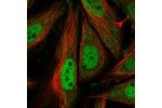 Immunofluorescent staining of human cell line SiHa shows localization to nucleoplasm.