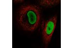 Immunofluorescent staining of human cell line A549 shows localization to nucleoplasm.
