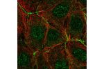 Immunofluorescent staining of human cell line MCF7 shows localization to nucleoplasm, plasma membrane & cell junctions.