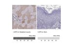 Immunohistochemistry analysis in human skeletal muscle and skin tissues using Anti-UCP3 antibody. Corresponding UCP3 RNA-seq data are presented for the same tissues.
