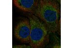Immunofluorescent staining of human cell line HaCaT shows localization to endoplasmic reticulum.
