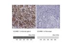 Immunohistochemistry analysis in human adrenal gland and pancreas tissues using Anti-SCARB1 antibody. Corresponding SCARB1 RNA-seq data are presented for the same tissues.