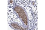 Immunohistochemical staining of human gallbladder shows extracellular positivity.