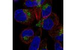Immunofluorescent staining of human cell line RH-30 shows localization to vesicles.
