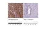 Immunohistochemistry analysis in human heart muscle and lymph node tissues using Anti-GOT1 antibody. Corresponding GOT1 RNA-seq data are presented for the same tissues.