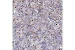 Immunohistochemical staining of human pituitary gland shows strong nuclear positivity in glandular cells.