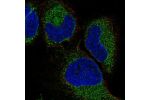 Immunofluorescent staining of human cell line HeLa shows localization to endoplasmic reticulum.