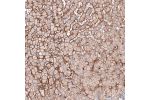 Immunohistochemical staining of human liver shows moderate to strong membranous positivity in hepatocytes.