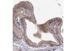 Immunohistochemical staining of human gallbladder shows moderate cytoplasmic positivity in glandular cells.