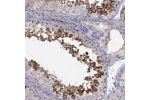 Immunohistochemical staining of human testis shows strong membranous positivity in cells in seminiferous ducts.
