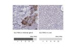 Immunohistochemistry analysis in human adrenal gland and liver tissues using HPA073224 antibody. Corresponding SLC18A2 RNA-seq data are presented for the same tissues.