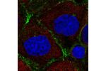 Immunofluorescent staining of human cell line A-431 shows localization to plasma membrane.