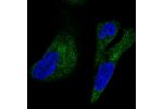 Immunofluorescent staining of human cell line RH-30 shows localization to endoplasmic reticulum.
