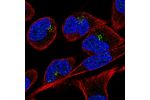 Immunofluorescent staining of human cell line RH-30 shows localization to the Golgi apparatus.