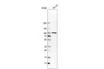 Western blot analysis in human cell line RH-30.