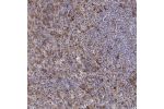 Immunohistochemical staining of human spleen shows strong positivity in subset of cells in red and white pulp.