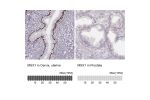 Immunohistochemistry analysis in human cervix, uterine and prostate tissues using Anti-MSX1 antibody. Corresponding MSX1 RNA-seq data are presented for the same tissues.