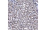Immunohistochemical staining of human liver shows moderate cytoplasmic positivity in hepatocytes.