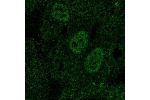 Immunofluorescent staining of human cell line HUVEC TERT2 shows localization to nucleoplasm.