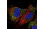 Immunofluorescent staining of human cell line U-251 MG shows localization to cytosol.