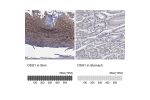 Immunohistochemistry analysis in human skin and stomach tissues using Anti-DSG1 antibody. Corresponding DSG1 RNA-seq data are presented for the same tissues.