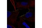 Immunofluorescent staining of human cell line U-251 MG shows localization to plasma membrane.