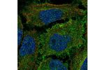 Immunofluorescent staining of human cell line HeLa shows localization to plasma membrane.