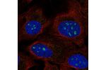 Immunofluorescent staining of human cell line U-2 OS shows localization to nucleoli & vesicles.