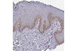 Immunohistochemical staining of human skin shows strong cytoplasmic positivity in epidermal cells in the basal layer.