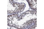 Immunohistochemical staining of human testis shows strong nuclear positivity in cells in seminiferous ducts.