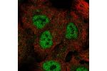 Immunofluorescent staining of human cell line A549 shows localization to nucleoplasm & vesicles.
