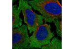 Immunofluorescent staining of human cell line U-2 OS shows localization to plasma membrane & cytosol.