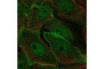 Immunofluorescent staining of human cell line MCF7 shows localization to nucleoplasm & plasma membrane.
