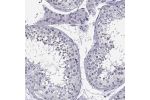 Immunohistochemical staining of human testis shows moderate positivity in subset of cells in seminiferous ducts.