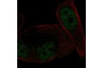 Immunofluorescent staining of human cell line PC-3 shows localization to nucleoplasm.