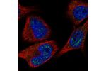 Immunofluorescent staining of human cell line SK-MEL-30 shows localization to nuclear speckles.