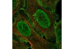 Immunofluorescent staining of human cell line U-2 OS shows localization to nucleoplasm, plasma membrane & the Golgi apparatus.