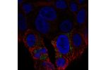 Immunofluorescent staining of human cell line RT4 shows localization to mitochondria.