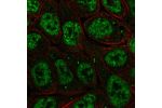 Immunofluorescent staining of human cell line RT4 shows localization to nuclear speckles & cytoplasmic bodies.