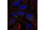 Immunofluorescent staining of human cell line RH-30 shows localization to the Golgi apparatus & vesicles.