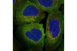 Immunofluorescent staining of human cell line U-2 OS shows localization to plasma membrane & endoplasmic reticulum.