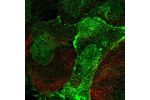 Immunofluorescent staining of human cell line EFO-21 shows localization to nucleoplasm, nuclear membrane & plasma membrane.