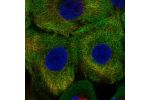 Immunofluorescent staining of human cell line HaCaT shows localization to cytosol & endoplasmic reticulum.