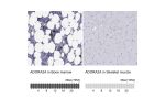 Immunohistochemistry analysis in human bone marrow and skeletal muscle tissues using HPA075997 antibody. Corresponding ADORA2A RNA-seq data are presented for the same tissues.