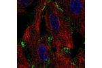 Immunofluorescent staining of human cell line A549 shows localization to plasma membrane & cell junctions.
